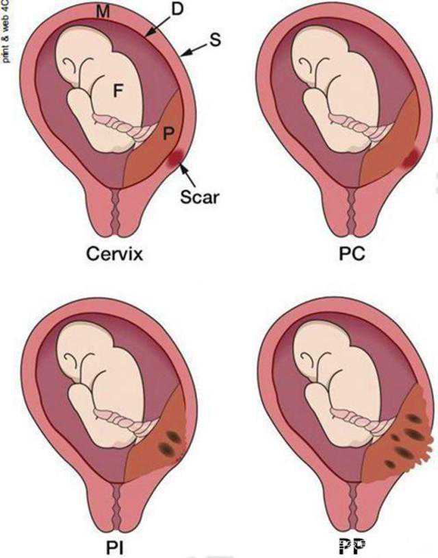 广州供卵生殖服务，点亮生命希望与彩虹