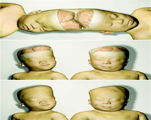 金华口腔医院与婺城口腔医院种植牙服务对比及助孕相关资讯