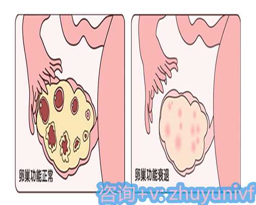 第三代供卵试管对子宫条件的具体要求解析