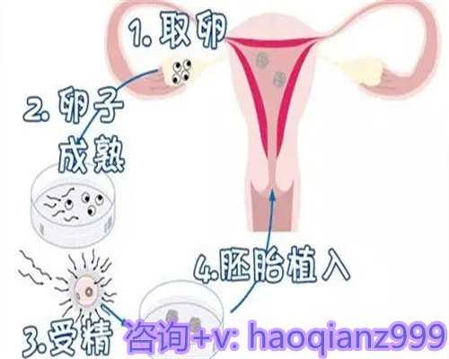 代孕上门洽谈：科技助孕的优势与费用解析